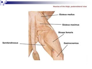 Semitendinosus Gastrocnemius
Biceps femoris
Gluteus maximus
Gluteus medius
 