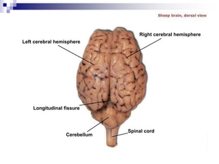 Left cerebral hemisphere
Longitudinal fissure
Cerebellum
Right cerebral hemisphere
Spinal cord
 