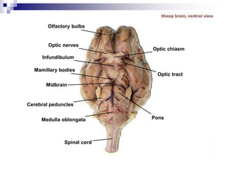 Olfactory bulbs
Optic nerves
Infundibulum
Mamillary bodies
Midbrain
Cerebral peduncles
Medulla oblongata
Spinal cord
Optic chiasm
Optic tract
Pons
 