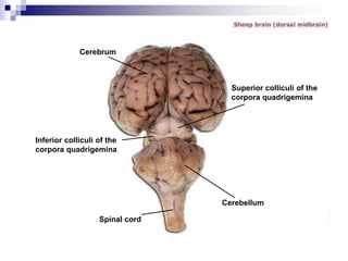 Cerebrum
Inferior colliculi of the
corpora quadrigemina
Superior colliculi of the
corpora quadrigemina
Spinal cord
Cerebellum
 