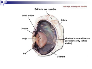 Extrinsic eye muscles
Sclera
Cornea
Lens, whole
Pupil
Iris
Vitreous humor within the
posterior cavity (retina
visible)
Choroid
 