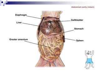 Diaphragm
Liver
Greater omentum
Gallbladder
Stomach
Spleen
 