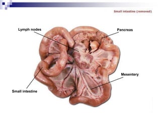 Lymph nodes
Small intestine
Pancreas
Mesentery
 