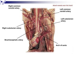 Right common
carotid artery
Right subclavian artery
Brachiocephalic artery
Arch of aorta
Left subclavian
artery
Left common
carotid artery
 