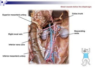 Superior mesenteric artery
Right renal vein
Inferior vena cava
Inferior mesenteric artery
Descending
aorta
Celiac trunk
 