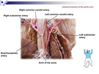 Right subclavian artery
Brachiocephalic
artery
Arch of the aorta
Left subclavian
artery
Left common carotid artery
Right common carotid artery
 