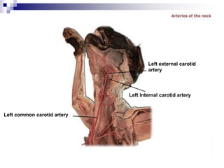 Left common carotid artery
Left internal carotid artery
Left external carotid
artery
 
