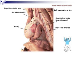 Brachiocephalic artery
Arch of the aorta
Heart
Intercostal arteries
Descending aorta
(thoracic aorta)
Left subclavian artery
 