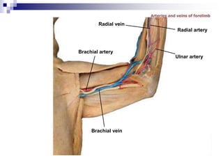 Radial vein
Brachial artery
Brachial vein
Ulnar artery
Radial artery
 