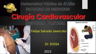 Felipe Salcedo Javercato
Dr. SOSSA
2015
 