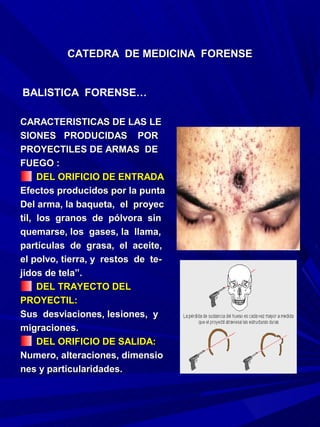CATEDRA DE MEDICINA FORENSE


BALISTICA FORENSE…

CARACTERISTICAS DE LAS LE
SIONES PRODUCIDAS POR
PROYECTILES DE ARMAS DE
FUEGO :
     DEL ORIFICIO DE ENTRADA
Efectos producidos por la punta
Del arma, la baqueta, el proyec
til, los granos de pólvora sin
quemarse, los gases, la llama,
partículas de grasa, el aceite,
el polvo, tierra, y restos de te-
jidos de tela”.
     DEL TRAYECTO DEL
PROYECTIL:
Sus desviaciones, lesiones, y
migraciones.
     DEL ORIFICIO DE SALIDA:
Numero, alteraciones, dimensio
nes y particularidades.
 