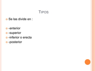 TIPOS
 Se las divide en :
 -anterior
 -superior
 -inferior o erecta
 -posterior
 