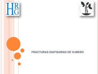 FRACTURAS DIAFISARIAS DE HÚMERO
 