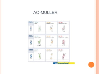 AO-MULLER
 