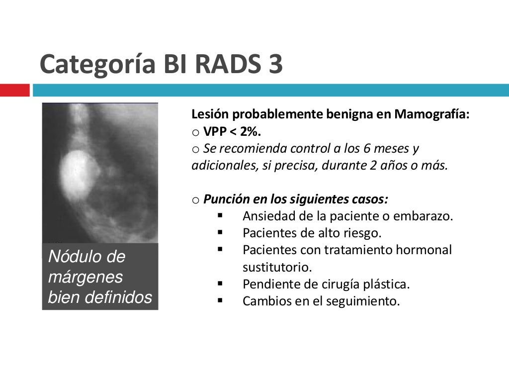 Bi Rads 4 Benigno , Breast Imaging Reporting & Data System (BI-RADS ...
