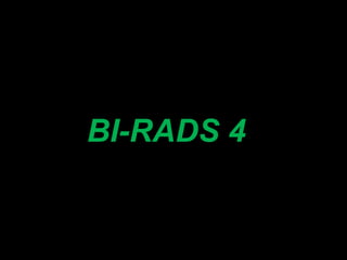 BI-RADS 4
 