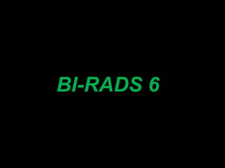 BI-RADS 6
 