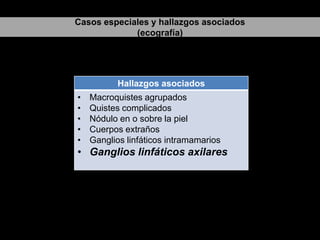 Casos especiales y hallazgos asociados
(ecografía)

Hallazgos asociados
•
•
•
•
•

Macroquistes agrupados
Quistes complicados
Nódulo en o sobre la piel
Cuerpos extraños
Ganglios linfáticos intramamarios

• Ganglios linfáticos axilares

 