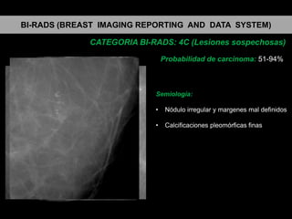 BI-RADS (BREAST IMAGING REPORTING AND DATA SYSTEM)
CATEGORIA BI-RADS: 4C (Lesiones sospechosas)
Probabilidad de carcinoma: 51-94%

Semiología:
•

Nódulo irregular y margenes mal definidos

•

Calcificaciones pleomórficas finas

 