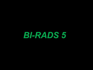 BI-RADS 5

 