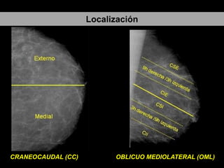 Localización

CRANEOCAUDAL (CC)

OBLICUO MEDIOLATERAL (OML)

 