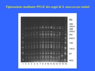 Tipizzazione mediante PFGE dei ceppi di S. marcescens isolati
 