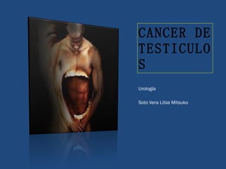 CANCER DE TESTICULOS ,[object Object],[object Object]