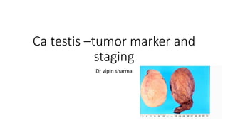 Ca testis –tumor marker and
staging
Dr vipin sharma
 