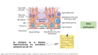 Sitio
santuario
Cheng L, Albers P, Berney DM, Feldman DR, Daugaard G, Gilligan T, Looijenga LHJ. Testicular cancer. Nat Rev Dis Primers. 2018 Oct 5;4(1):29. doi: 10.1038/s41572-018-
 