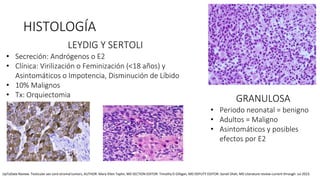 LEYDIG Y SERTOLI
• Secreción: Andrógenos o E2
• Clínica: Virilización o Feminización (<18 años) y
Asintomáticos o Impotencia, Disminución de Líbido
• 10% Malignos
• Tx: Orquiectomia
GRANULOSA
• Periodo neonatal = benigno
• Adultos = Maligno
• Asintomáticos y posibles
efectos por E2
HISTOLOGÍA
UpToDate Review. Testicular sex cord stromal tumors, AUTHOR: Mary-Ellen Taplin, MD SECTION EDITOR: Timothy D Gilligan, MD DEPUTY EDITOR: Sonali Shah, MD Literature review current through: Jul 2023.
 