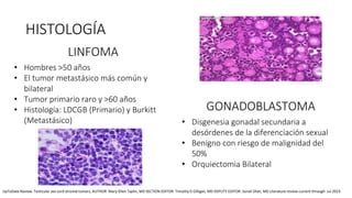 LINFOMA
• Hombres >50 años
• El tumor metastásico más común y
bilateral
• Tumor primario raro y >60 años
• Histología: LDCGB (Primario) y Burkitt
(Metastásico)
GONADOBLASTOMA
• Disgenesia gonadal secundaria a
desórdenes de la diferenciación sexual
• Benigno con riesgo de malignidad del
50%
• Orquiectomia Bilateral
HISTOLOGÍA
UpToDate Review. Testicular sex cord stromal tumors, AUTHOR: Mary-Ellen Taplin, MD SECTION EDITOR: Timothy D Gilligan, MD DEPUTY EDITOR: Sonali Shah, MD Literature review current through: Jul 2023.
 