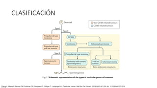 CLASIFICACIÓN
Cheng L, Albers P, Berney DM, Feldman DR, Daugaard G, Gilligan T, Looijenga LHJ. Testicular cancer. Nat Rev Dis Primers. 2018 Oct 5;4(1):29. doi: 10.1038/s41572-018-
 