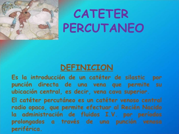 Cateter Cateter