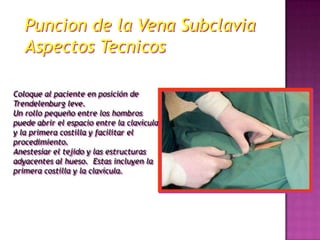 Puncion de la Vena Subclavia
   Aspectos Tecnicos

Coloque al paciente en posición de
Trendelenburg leve.
Un rollo pequeño entre los hombros
puede abrir el espacio entre la clavícula
y la primera costilla y facilitar el
procedimiento.
Anestesiar el tejido y las estructuras
adyacentes al hueso. Estas incluyen la
primera costilla y la clavícula.
 