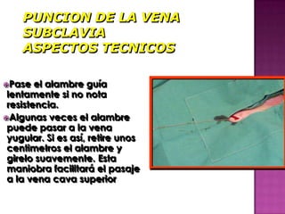 Pase   el alambre guía
 lentamente si no nota
 resistencia.
Algunas veces el alambre
 puede pasar a la vena
 yugular. Si es así, retire unos
 centimetros el alambre y
 girelo suavemente. Esta
 maniobra facilitará el pasaje
 a la vena cava superior
 