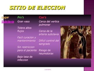 Lugar       Pro’s              Con’s
Subclavia   Gran vaso          Cerca del vertice
                               pulmonar
            Tolera altos
            flujos             Cerca de la
                               arteria subclavia
            Facil curacion y
            mantenimiento      Dificil control del
                               sangrado
            Sin restriccion
            para el paciente Riesgo de
                             neumotorax
            Baja tasa de
            infeccion


                                    3/10/2013
 