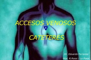 ACCESOS VENOSOS CATETERES Dr. Eduardo Ferraresi Htal. R.Rossi / La Plata  ∆ 
