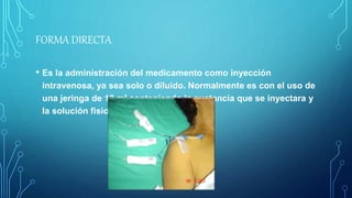 FORMA DIRECTA
• Es la administración del medicamento como inyección
intravenosa, ya sea solo o diluido. Normalmente es con el uso de
una jeringa de 13 ml conteniendo la sustancia que se inyectara y
la solución fisiológica.
 