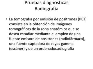 Pruebas diagnosticas
               Radiografia
• La tomografía por emisión de positrones (PET)
  consiste en la obtención de imágenes
  tomográficas de la zona anatómica que se
  desea estudiar mediante el empleo de una
  fuente emisora de positrones (radiofármaco),
  una fuente captadora de rayos gamma
  (escáner) y de un ordenador.adiografía
 