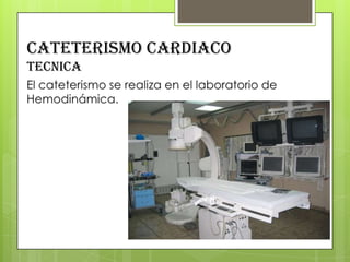 CATETERISMO CARDIACO
tecnica

 