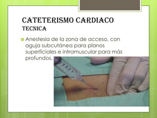 CATETERISMO CARDIACO
tecnica
 Anestesia

de la zona de acceso, con
aguja subcutánea para planos
superficiales e intramuscular para más
profundos.

 