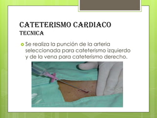 CATETERISMO CARDIACO
tecnica
 Se

realiza la punción de la arteria
seleccionada para cateterismo izquierdo
y de la vena para cateterismo derecho.

 