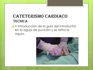 CATETERISMO CARDIACO
tecnica
•

Introducción de la guía del introductor
en la aguja de punción y se retira la
aguja,

 