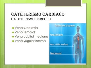 CATETERISMO CARDIACO
cateterismo derecho
 Vena

subclavia
 Vena femoral
 Vena cubital mediana
 Vena yugular interna

 