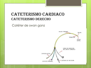 CATETERISMO CARDIACO
cateterismo derecho
Catéter de swan ganz

 