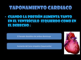 Cateterismo cardiaco