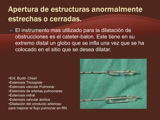 

El instrumento mas utilizado para la dilatación de
obstrucciones es el cateter-balon. Este tiene en su
extremo distal un globo que se infla una vez que se ha
colocado en el sitio que se desea dilatar.

•Enf. Budd- Chiari
•Estenosis Tricúspide
•Estenosis valvular Pulmonar
•Estenosis de arterias pulmonares
•Estenosis mitral
•Estenosis valvular aortica
•Dilatación del conducto arterioso
para mejorar el flujo pulmonar en RN

 