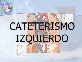 Ao
VI
CATETERISMO
IZQUIERDO
 