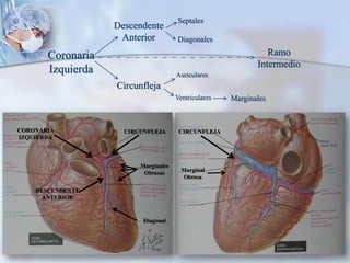 Coronaria
Izquierda
Descendente
Anterior
Circunfleja
Septales
Diagonales
Auriculares
Ventriculares Marginales
Ramo
Intermedio
CORONARIA
IZQUIERDA
DESCENDENTE
ANTERIOR
CIRCUNFLEJA
Marginales
Obtusas
Diagonal
CIRCUNFLEJA
Marginal
Obtusa
 
