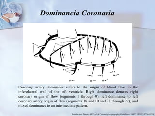 Coronary artery dominance refers to the origin of blood flow to the
inferolateral wall of the left ventricle. Right dominance denotes right
coronary origin of flow (segments 1 through 9), left dominance to left
coronary artery origin of flow (segments 18 and 19 and 23 through 27), and
mixed dominance to an intermediate pattern.
Scanlon and Faxon. ACC/AHA Coronary Angiography Guidelines. JACC 1999;33;1756-1824
Dominancia Coronaria
 